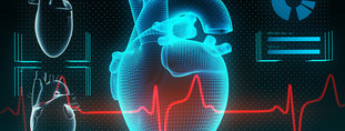 IRM_cardiaque