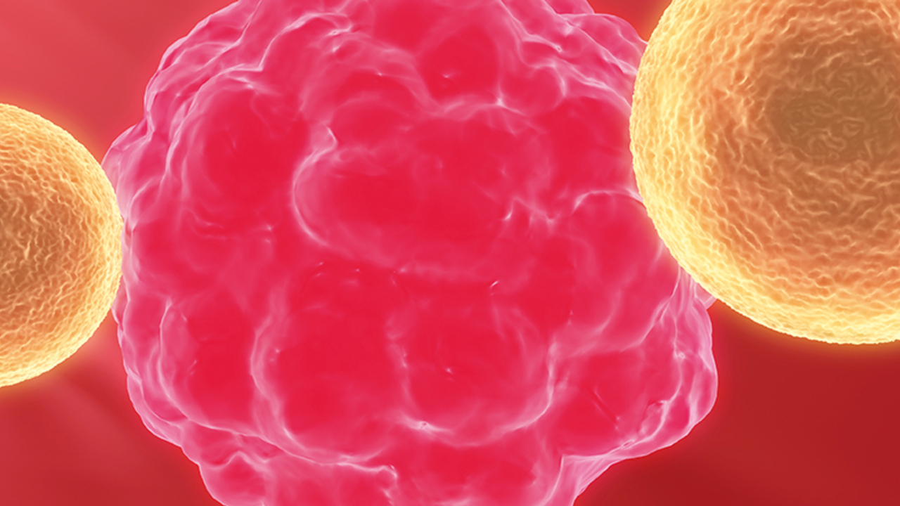 registre-des-tumeurs